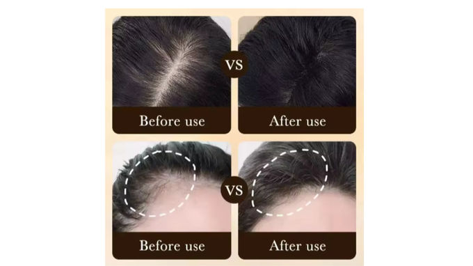 Hair Growth Treatment Scalp Serum For Thicker Fuller Hair - Image 2