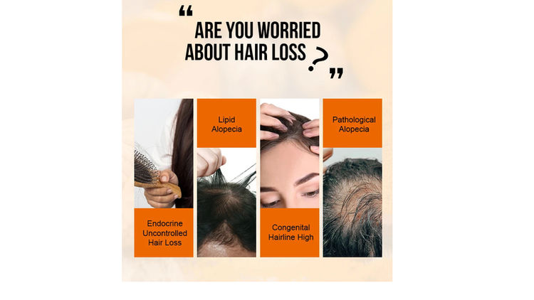 Ginger Hair Growth Oil For Stronger Fuller Thicker Hair PURC Scalp Treatment - Image 3