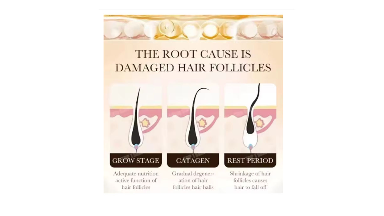 Hair Growth Roller With Scalp Serum For Thicker Fuller Hair Growth Treatment - Image 2