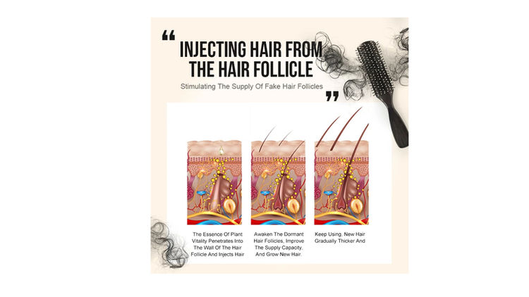 Ginger Hair Growth Oil For Stronger Fuller Thicker Hair PURC Scalp Treatment - Image 4