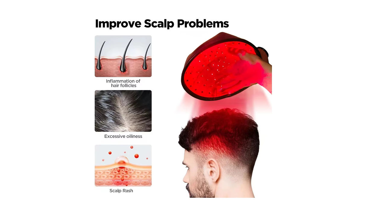 Hair Loss Laser Treatment 96 Diode Red Light Hair Growth Cap Scalp Women - Image 2