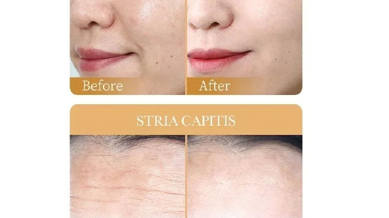 10pcs Collagen Sheet Mask Anti Aging Hydrating Firming Moisturizing Wrinkle Repa - Image 4